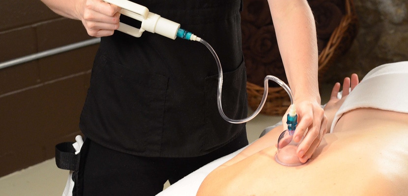 Terapie chinezeasca prin suctiune